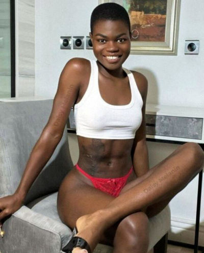 Daisy_melanin